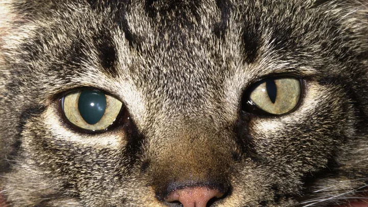 Anisocoria