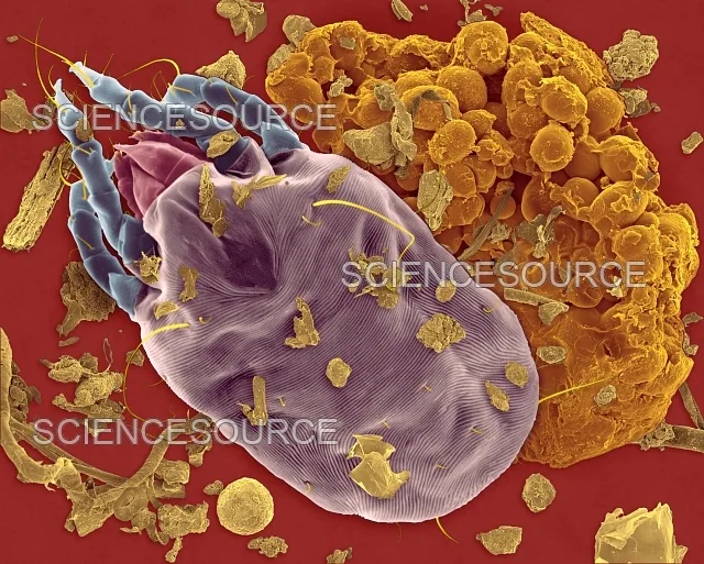 Dust mite allergens
