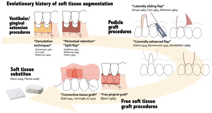 gum graft surgery