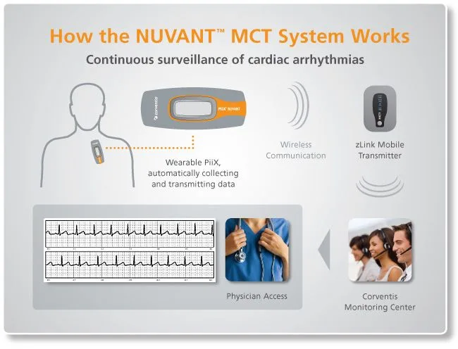 Mobile cardiac telemetry