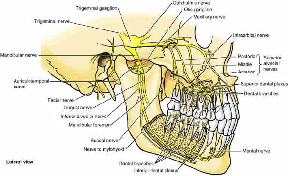 referred dental pain