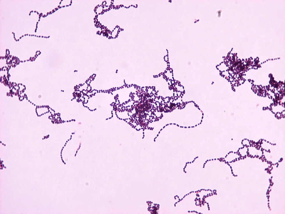 Streptococcus pyogenes bacteria